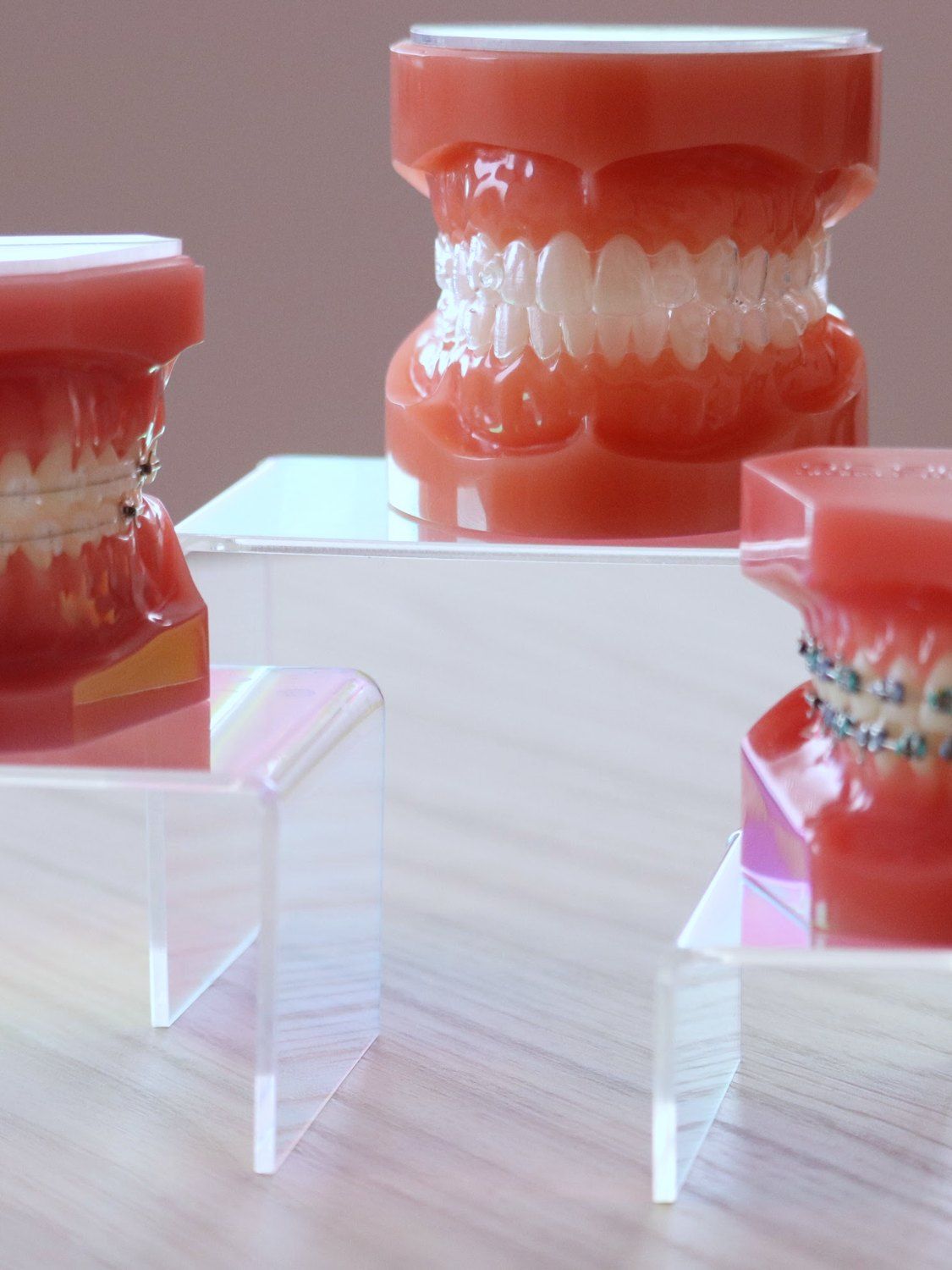 Three dental models showing braces options at Sparkle Orthodontics