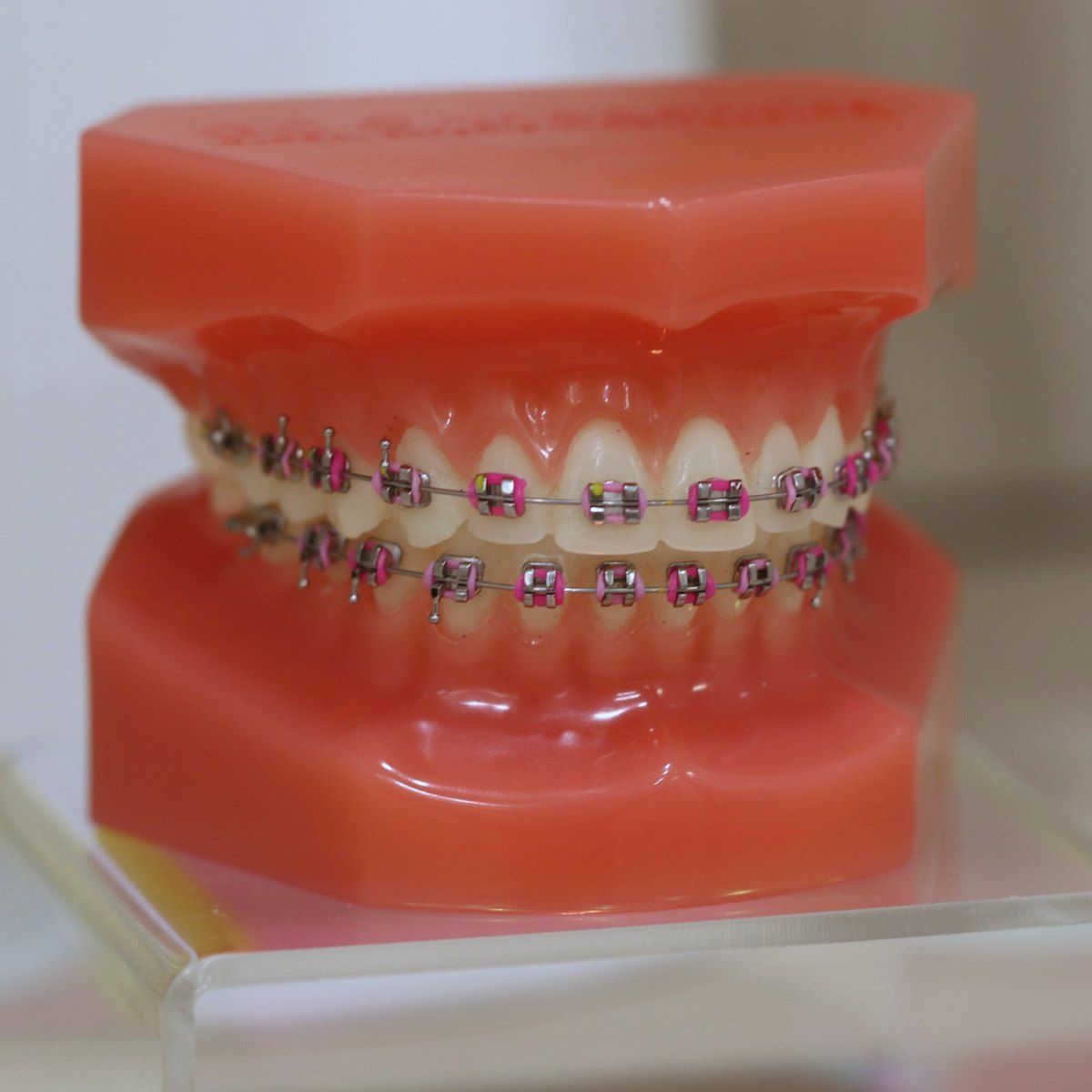 Braces close-up on a dental model