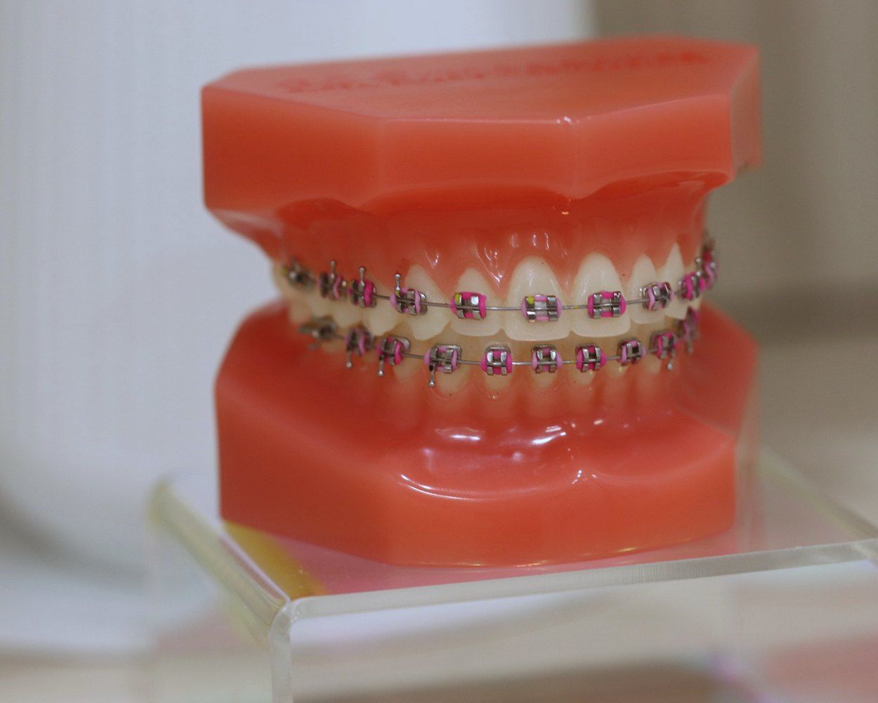 Braces close-up on a dental model