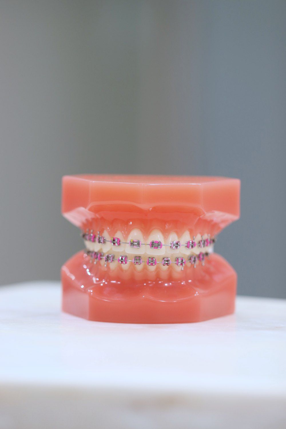 Dental model with braces