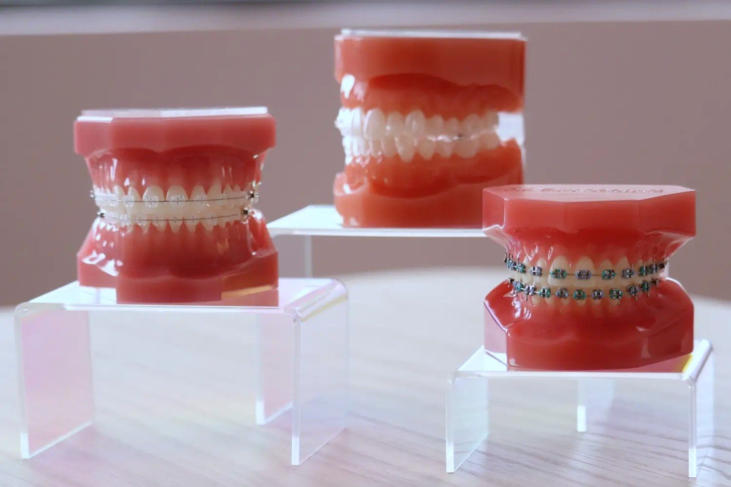 clear braces